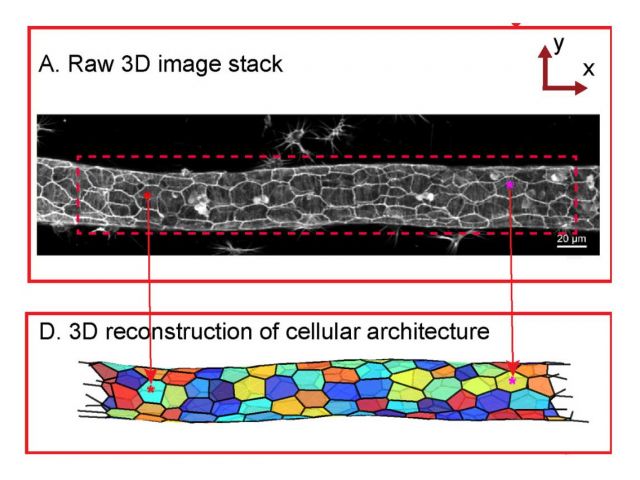 3D reconstruction of a blood vessel